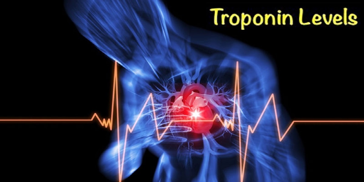   طراحی و ساخت حسگر زیستی موج صوتی برای شناسایی میزان تروپونین در سرم خون